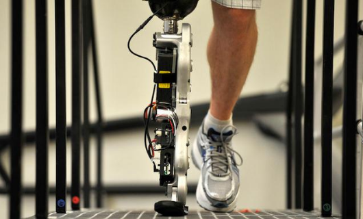 假肢價格較高產(chǎn)品材料有關系么(圖1)