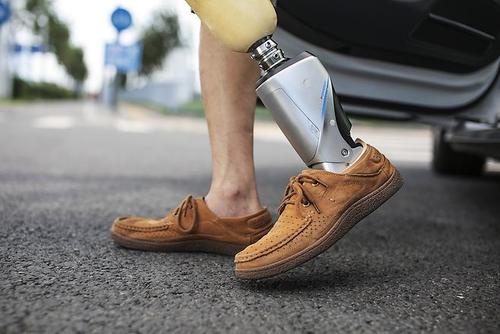 河南假肢廠家初裝假肢應(yīng)該怎么樣做呢(圖1) 河南假肢廠家初裝假肢應(yīng)該怎么樣做呢(圖1)