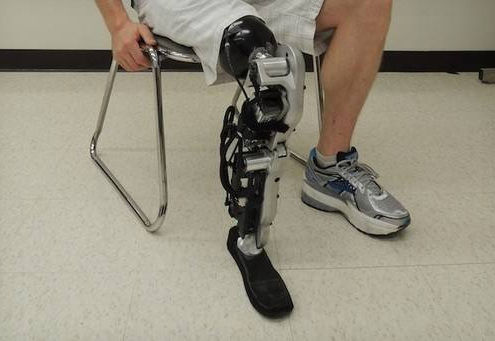 裝配一條腿的假肢價(jià)格大概多少錢(qián)?(圖1) 假肢價(jià)格